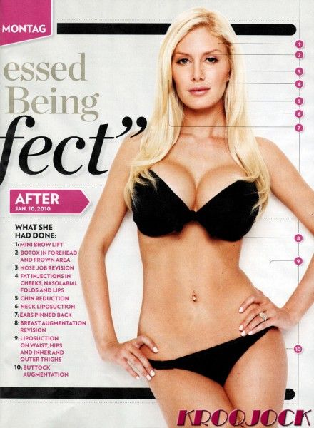 heidi montag plastic surgery 2010. heidi montag plastic surgery